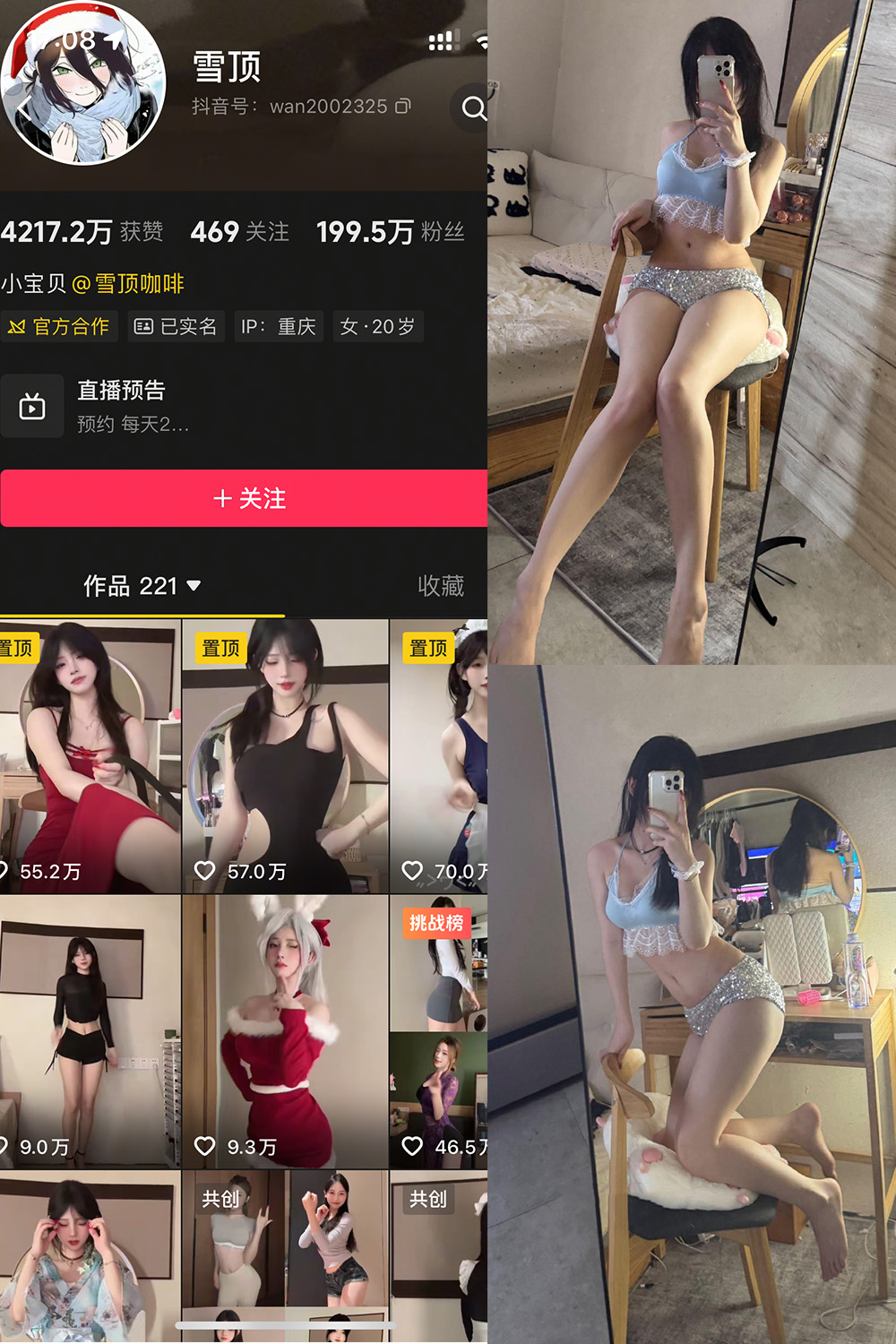 抖音 雪顶 岛遇 NO.017期 【25P1V】