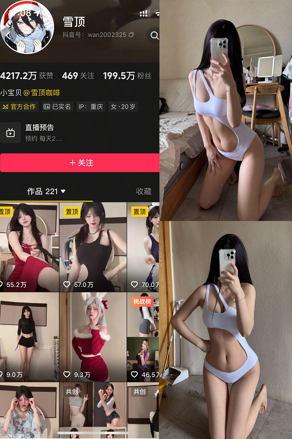 抖音 雪顶 岛遇 NO.014期 【25P】