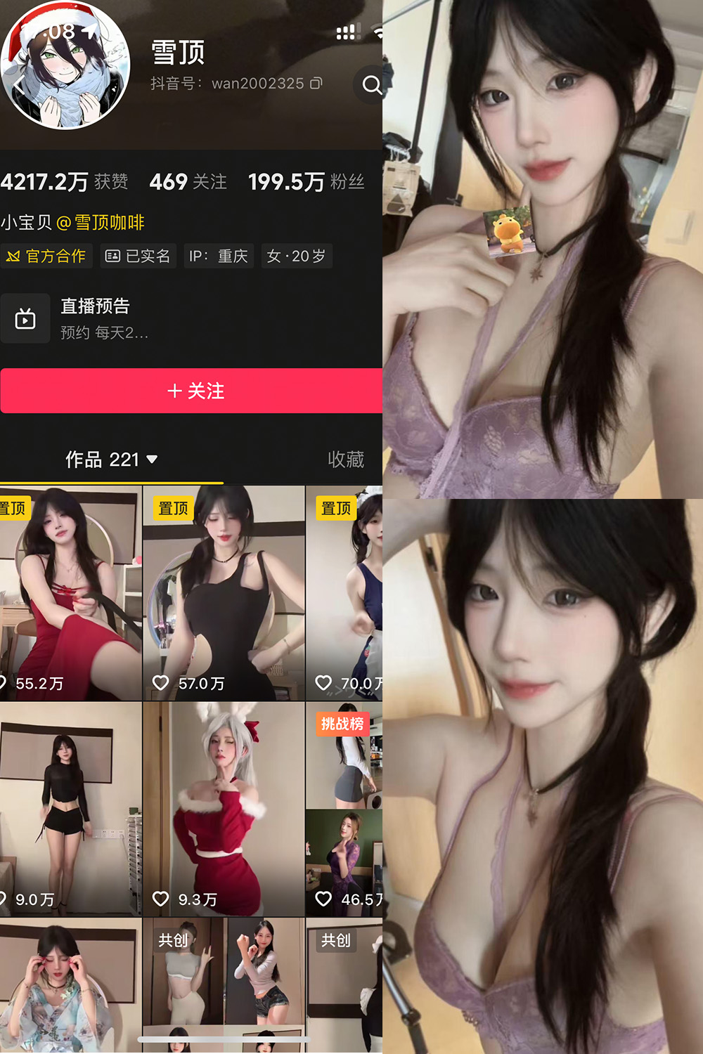 抖音 雪顶 岛遇 NO.021期 【12P7V】 - 绅士宝库